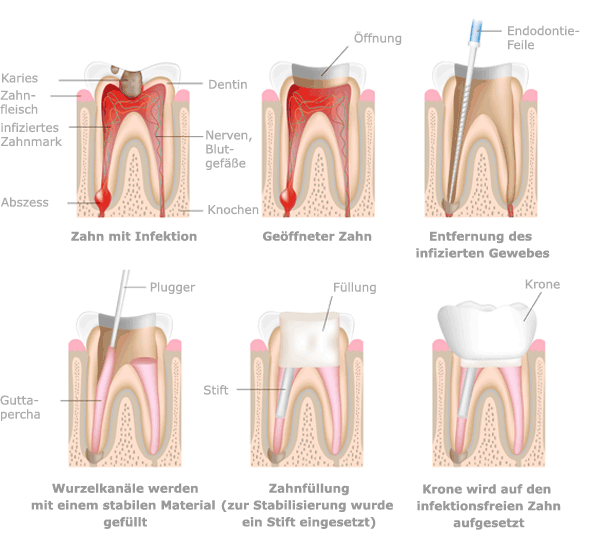 Endodontie